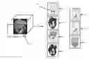 Fig. 01 - Method for memorable image generation for anonymized three-dimensional medical image workflows