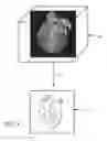 Fig. 04 - Method for memorable image generation for anonymized three-dimensional medical image workflows
