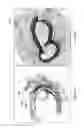 Fig. 07 - System and method of adventitial tissue characterization