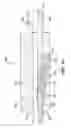 Fig. 02 - Cable-lock for orthopedic cables
