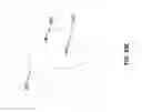 Fig. 35 - Prosthetic heart valves and apparatus and methods for delivery of same