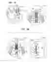 Fig. 07 - Implant for heart valve