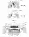 Fig. 09 - Implant for heart valve