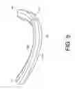 Fig. 06 - Non-Planar Cardio Vascular Support Prosthesis