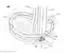 Fig. 01 - MEDICAL SECURING DEVICE FOR SECURING AN IMPLANT DEVICE WITH A SECURING MEMBER