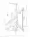 Fig. 04 - Patient transport apparatus with movable head section