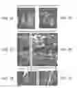 Fig. 11 - PROGRAMMING OF CELLS FOR TOLEROGENIC THERAPIES
