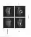 Fig. 03 - Long-lived gadolinium based tumor targeting imaging and therapy agents