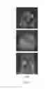 Fig. 09 - Long-lived gadolinium based tumor targeting imaging and therapy agents