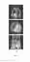 Fig. 10 - Long-lived gadolinium based tumor targeting imaging and therapy agents