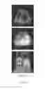 Fig. 11 - Long-lived gadolinium based tumor targeting imaging and therapy agents
