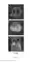 Fig. 12 - Long-lived gadolinium based tumor targeting imaging and therapy agents