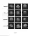 Fig. 18 - Long-lived gadolinium based tumor targeting imaging and therapy agents