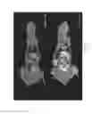 Fig. 20 - Long-lived gadolinium based tumor targeting imaging and therapy agents
