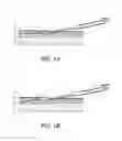 Fig. 02 - Assistive device for subcutaneous injections or implants