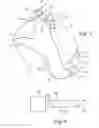 Fig. 02 - Positive-air-pressure machine conduit