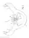 Fig. 03 - Positive-air-pressure machine conduit