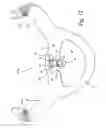 Fig. 08 - Positive-air-pressure machine conduit