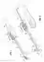 Fig. 02 - LOW PROFILE PASSIVE PROTECTOR FOR AN I.V. CATHETER