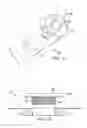 Fig. 02 - Apparatus and method for deploying a surgical preparation