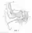 Fig. 02 - Fixation component for insertion tools for minimally invasive cochlear implants