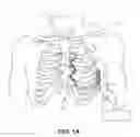 Fig. 02 - Supraventricular tachyarrhythmia discrimination