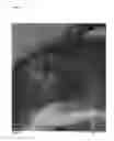 Fig. 02 - SCR-active material