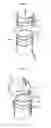 Fig. 09 - BOTTLE CLOSURE ASSEMBLY INCLUDING A POLYETHYLENE COMPOSITION