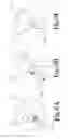 Fig. 06 - Portable Water Filtration Assembly