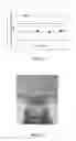 Fig. 02 - Process for treating water containing hydrocarbons by means of expanded graphite