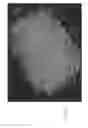 Fig. 34 - Morphic forms of marizomib and uses thereof