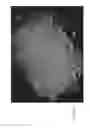 Fig. 35 - Morphic forms of marizomib and uses thereof