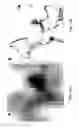 Fig. 17 - Optical microscopy with phototransformable optical labels