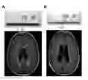 Fig. 01 - Diagnostic reagent kit for detecting chronic brain pathologies of ischemic genesis