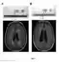 Fig. 03 - Diagnostic reagent kit for detecting chronic brain pathologies of ischemic genesis