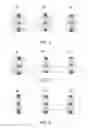 Fig. 04 - Method and associated device for rapid detection of target biomolecules with enhanced sensitivity