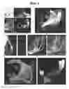 Fig. 04 - Methods for visualization and quantification of fiber-like structures