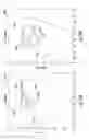 Fig. 23 - Optical device for enhancing human color vision with improved cosmetic appearance