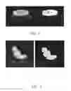 Fig. 03 - Method for identifying RT positioning image, computer program, and computer storage