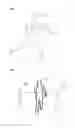 Fig. 11 - Device for measuring passing time of runner