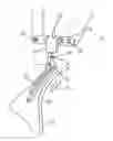 Fig. 01 - Instrument carrier with auto-release articulating back brace