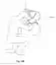 Fig. 19 - Instrument carrier with auto-release articulating back brace