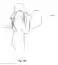 Fig. 20 - Instrument carrier with auto-release articulating back brace
