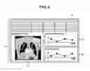 Fig. 03 - Medical information processing apparatus and medical information processing method
