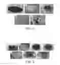 Fig. 02 - Suctionable gel and method for eliminating a contamination contained in a surface organic layer of a solid substrate