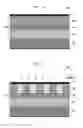 Fig. 03 - Patterning material film stack with metal-containing top coat for enhanced sensitivity in extreme ultraviolet (EUV) lithography