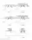 Fig. 03 - Method for manufacturing a metal gate