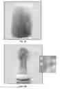 Fig. 04 - Biometric authentication of individuals utilizing characteristics of bone and blood vessel structures