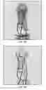 Fig. 06 - Biometric authentication of individuals utilizing characteristics of bone and blood vessel structures