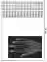 Fig. 09 - Biometric authentication of individuals utilizing characteristics of bone and blood vessel structures